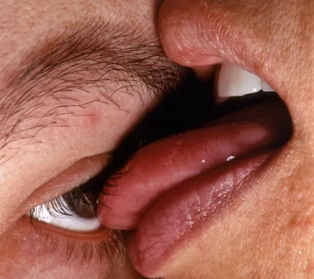 image of a tongue on an eyeball